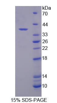 Human SDCBP2 / Syntenin 2 Protein (Recombinant His-T7)