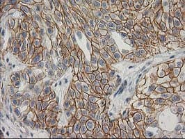 CTNNB1 / Beta Catenin Antibody (clone OTI1E10, Carrier-free)