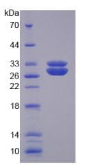 Human SOD3 Protein (Recombinant His-T7)