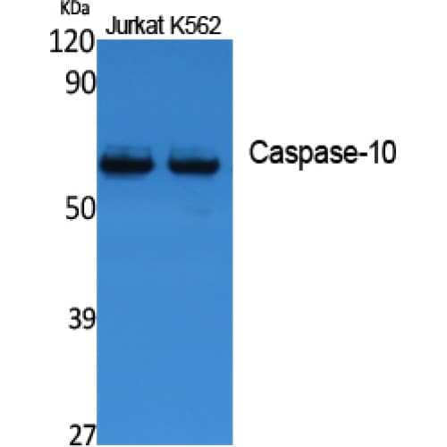 CASP10 / Caspase 10 Antibody (Internal)