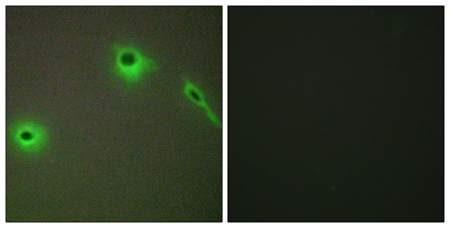 IHC-plus™ Polyclonal Rabbit anti-Human Endostatin Antibody (aa801-850, IHC, IF)