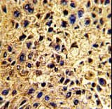 NUP62 Antibody (aa492-520)