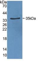 KDR / VEGFR2 / FLK1 Antibody (aa46-320, Cy3)