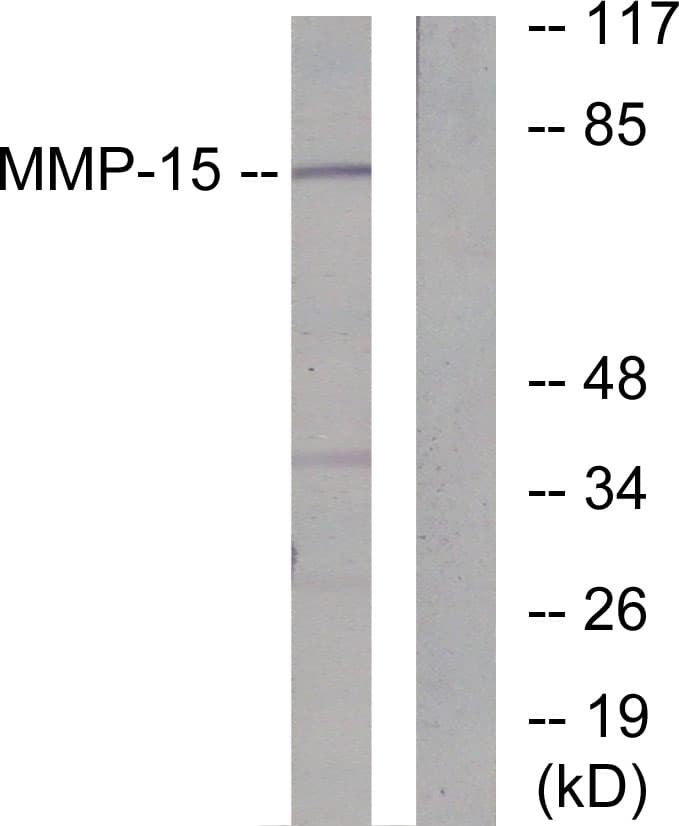 MMP15 Antibody (aa611-660)