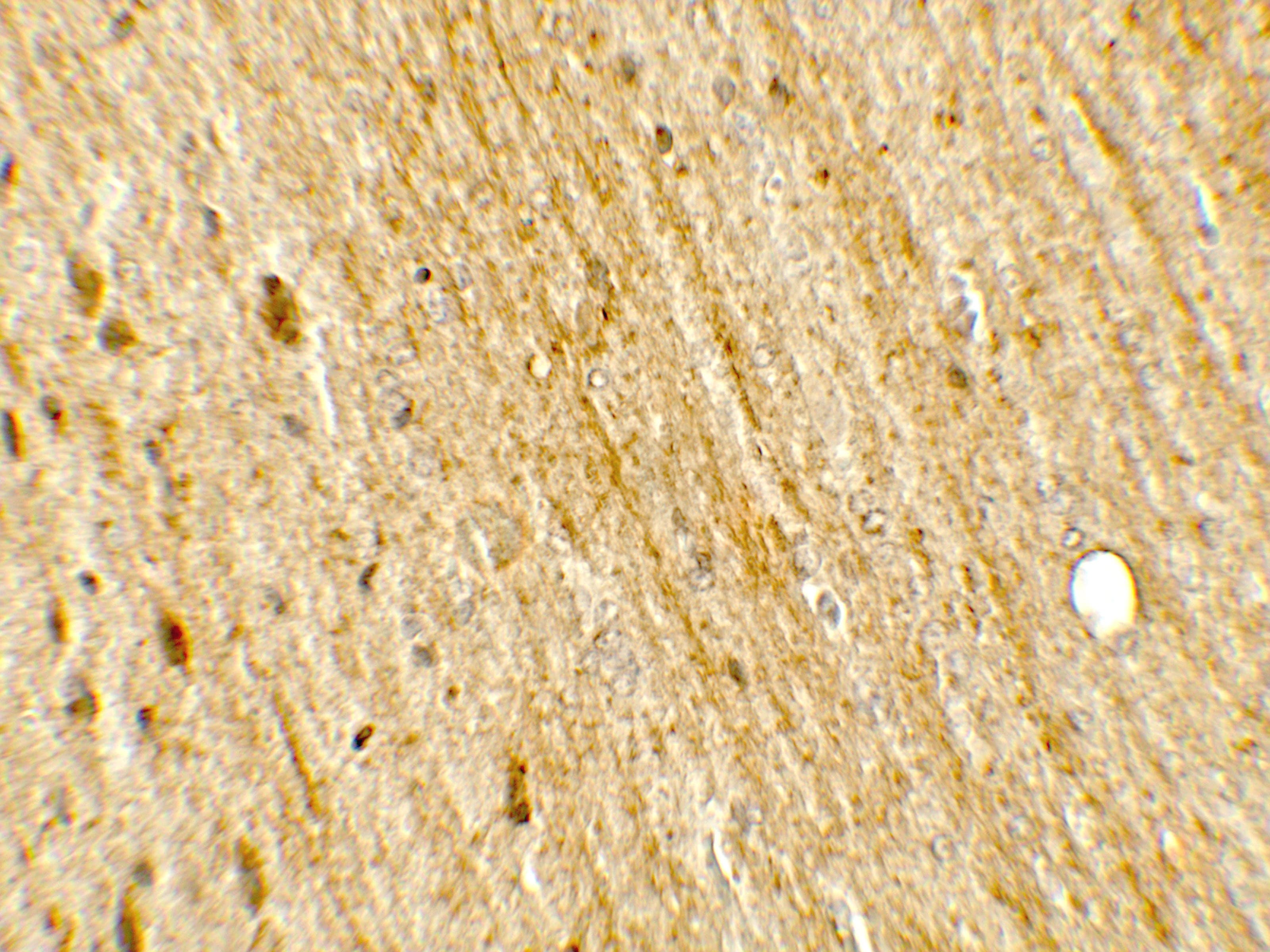 Polyclonal Rabbit anti-Human POU2F3 / PLA-1 Antibody (IHC, IF, WB)