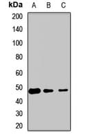 Polyclonal Rabbit anti-Human ETF1 / ERF1 Antibody (WB)