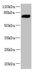 Polyclonal Rabbit anti-Human KLHL13 Antibody (IHC, WB)