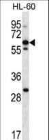 NPTXR / NPR Antibody (aa180-209)