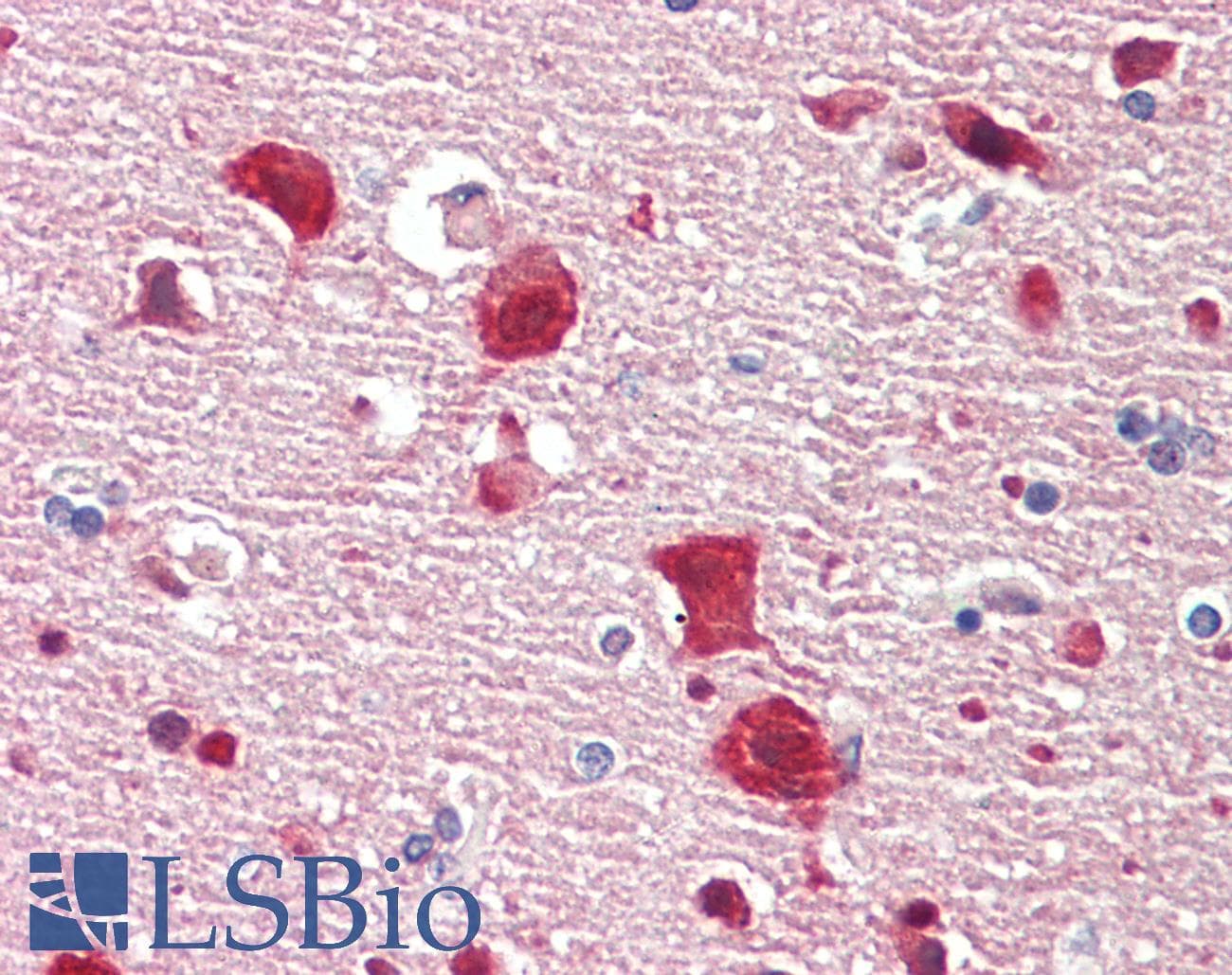 IHC-plus™ ELAVL2 / HUB Antibody (aa11-60)