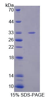 Mouse MMP20 Protein (Recombinant His-T7)