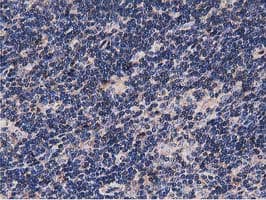 NUDT6 Antibody (clone OTI9D12)