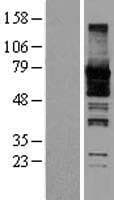 SEPT9 / Septin 9 Protein (Over-Expression Lysate Myc-DDK (Flag))