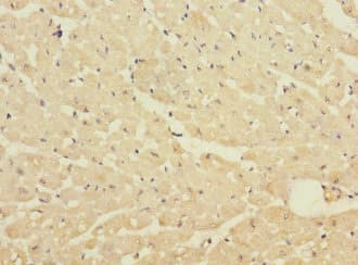 DNA2 Antibody