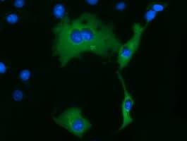 KLHL2 / MAV Antibody (clone OTI6D8)