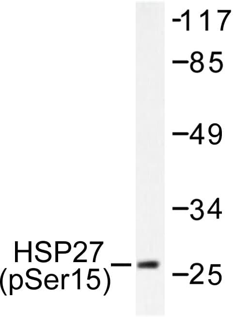 HSPB1 / HSP27 Antibody (phospho-Ser15)