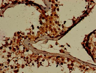 Polyclonal Rabbit anti-Human GARS / Glycyl tRNA Synthetase Antibody (IHC, IF, WB)