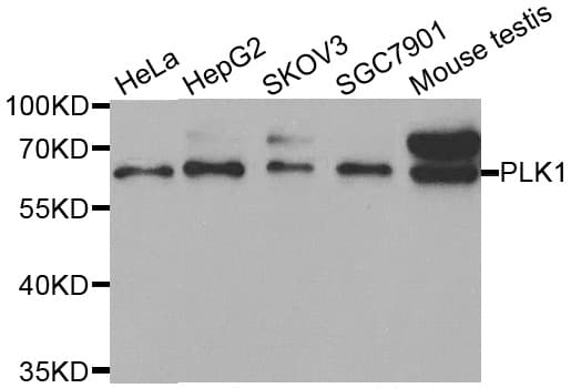 PLK1 / PLK-1 Antibody
