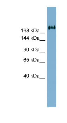 Polyclonal Rabbit anti-Human TMEM2 Antibody (aa1187-1236, WB)