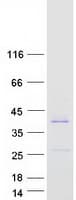 Human VSTM2B Protein (Recombinant Myc-DDK (Flag))