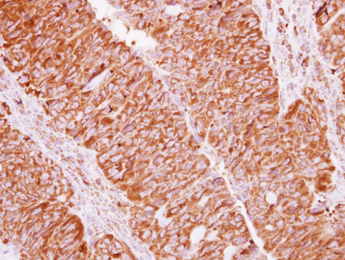 EIF2S2 Antibody