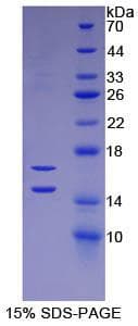 Human CCL2 / MCP1 Protein (Recombinant His)