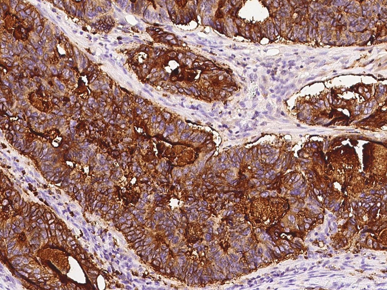 CD66c / CEACAM6 Antibody (Preservative Free)