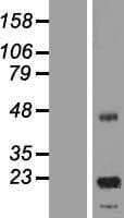 ASPDH Protein (Over-Expression Lysate Myc-DDK (Flag))