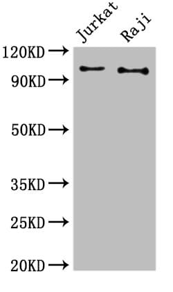 c-CBL Antibody