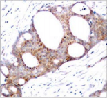 GSK3A / GSK3 Alpha Antibody