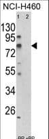 ACSS3 Antibody (aa224-251)
