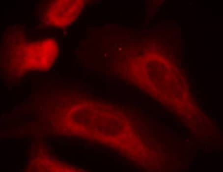 STAT1 Antibody (phospho-Ser727)