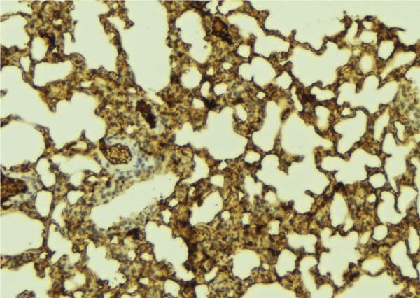 Polyclonal Rabbit anti-Human FOXO1 / FKHR Antibody (IHC, IF, WB)