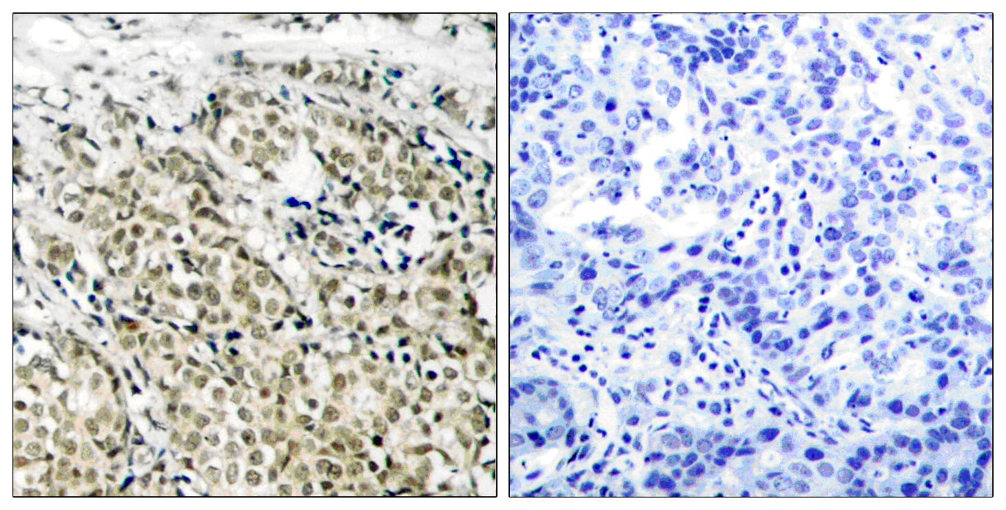 AR / Androgen Receptor Antibody (aa186-235)