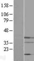 Endonuclease G / ENDOG Protein (Over-Expression Lysate Myc-DDK (Flag))