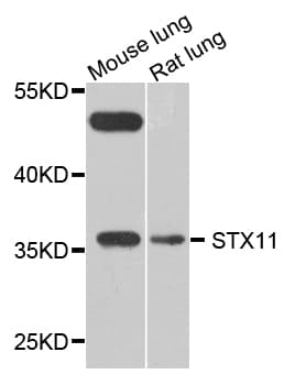 Polyclonal Rabbit anti-Human STX11 / Syntaxin 11 Antibody (WB)