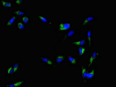 HSPC167 / CDK5RAP1 Antibody