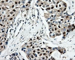 HDHD2 Antibody (clone OTI2C12)