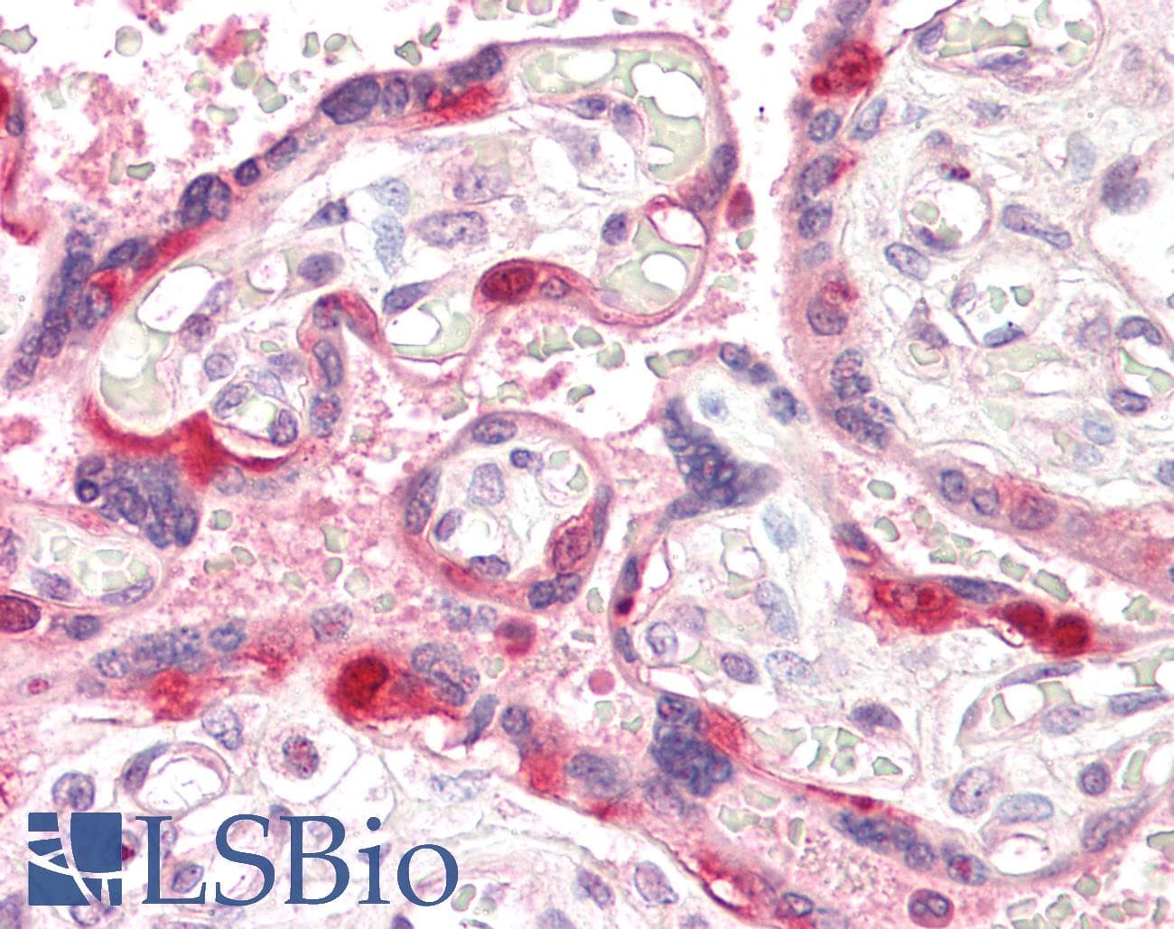 IHC-plus™ ARHGEF5 Antibody (aa476-487)