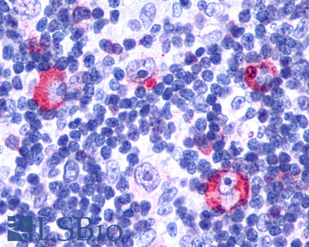 PathPlus™ Polyclonal Rabbit anti-Human GPR146 Antibody (Cytoplasmic Domain, IHC)