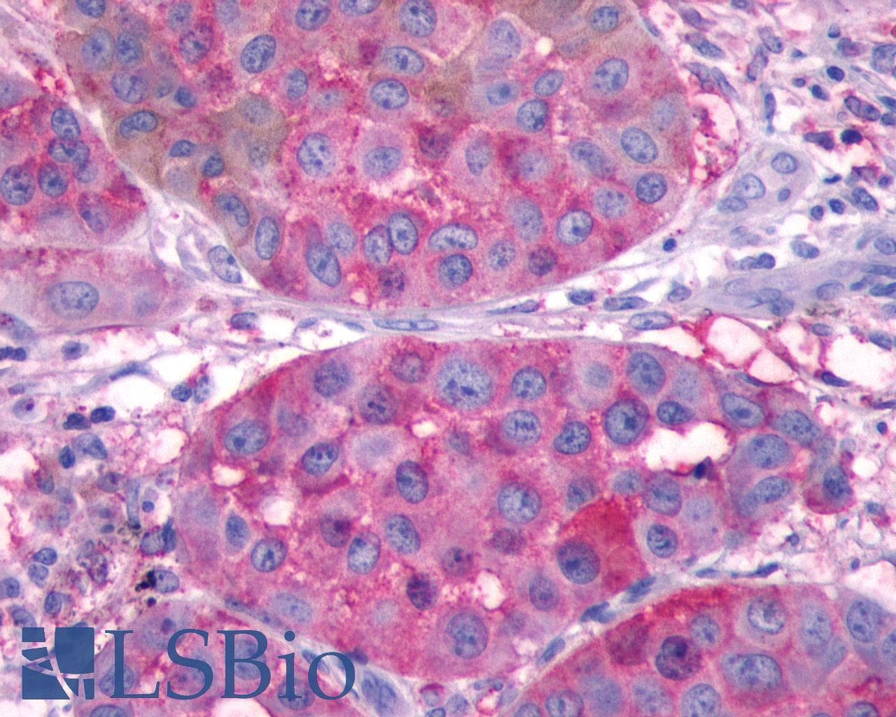 IHC-plus™ SSTR2 Antibody (Extracellular Domain)