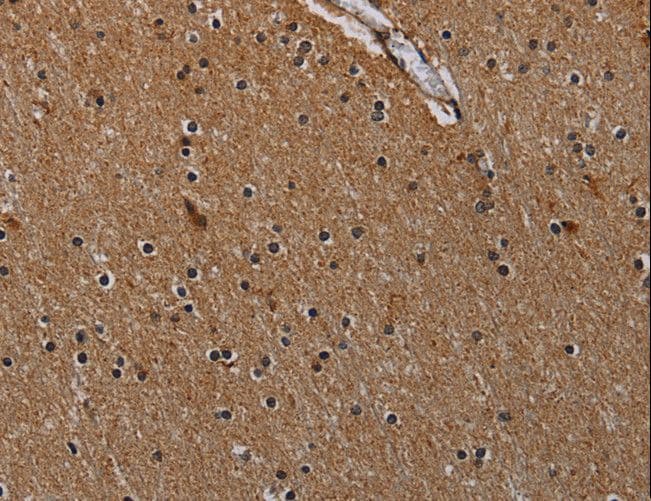 IVL / Involucrin Antibody