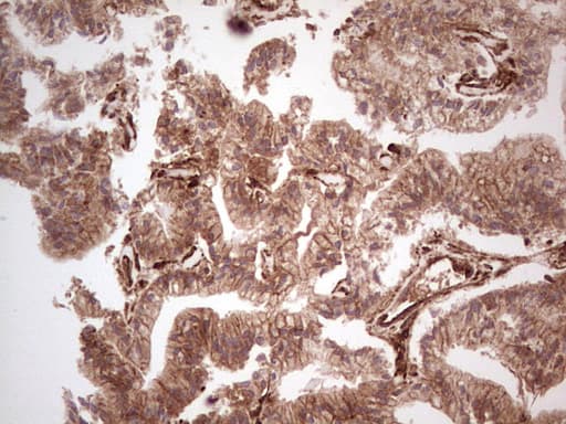 LGALS9 / Galectin 9 Antibody (clone OTI1D12)