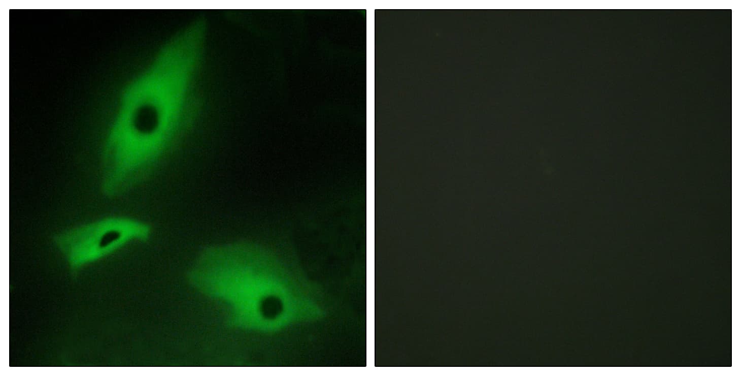 LTBR Antibody (aa11-60)