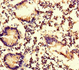 MYO1G / HA2 Antibody