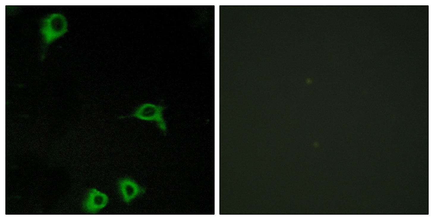 Polyclonal Rabbit anti-Human ADGRE2 / EMR2 Antibody (IF, WB)