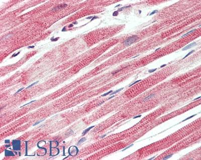 IHC-plus™ DDR2 Antibody