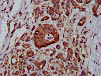 Polyclonal Rabbit anti-Human MTBP / Mdm2-Binding Protein Antibody (IHC)