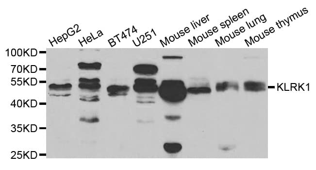 KLRK1 / CD314 / NKG2D Antibody