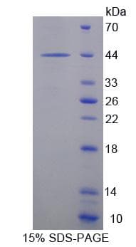 Human PROK1 / EG-VEGF Protein (Recombinant His-T7)