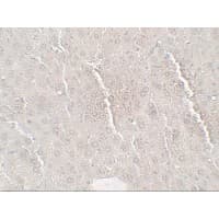 Polyclonal Rabbit anti-Human ANGPTL8 / Betatrophin Antibody (IHC, IF, WB)